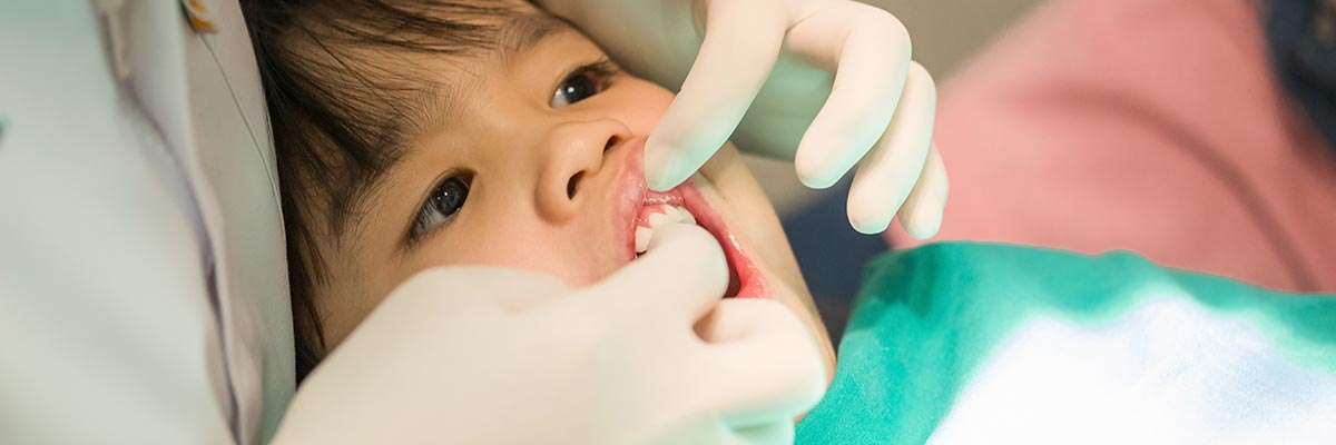 root-canal-treatment-in-south-kolkata